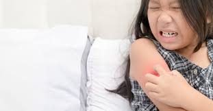 Getting To The Root Of Ringworm Causes And Prevention Images of tinea faciei (ringworm of face). children s hospital los angeles