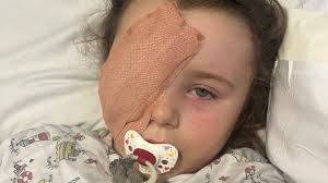 Fundraiser by Ciara Grainger : Donate to help ruby recover from losing her  right eye