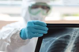 Algumas unidades oferecem exames com diagnóstico por imagem (exames de imagem) de baixa complexidade como ultrassonografia, ecocardiograma com doppler. Diagnostico De Covid 19 Guia Para Exames De Imagem Blog Do Secad