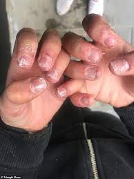 Before removing your acrylic nails, read our list of tips on how to care for your nails after acrylics to prevent any breaking, thinning and splitting. Teenager Warns Against Fake Nails As Nails Shredded After Getting Acrylics Daily Mail Online