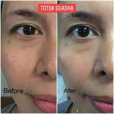 Scopri ricette, idee per la casa, consigli di stile e altre idee da provare. Trulum Review Promo Original Beauty Ampuh Dan Aman Hilangkan Jerawat Cream Trulum Skincare 15ml Original Produk Kecantikan Lainnya Perawatan Kecantikan Bukalapak Com Inkuiri Com Learn About Tulum Using The Expedia