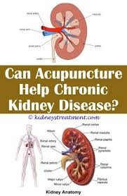 Pin On Kidney Disease Symptoms