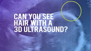 So we made our weekly visit to the doctor's office to find our how things are going. Can You See Hair In A 3d Ultrasound 3d Ultrasound And 4d Ultrasound Orlando Florida 3d Ultrasound And 4d Ultrasound Orlando Florida Gender Ultrasounds In Orlando