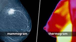 Women diagnosed with breast cancer after having yearly mammograms were diagnosed with cancers that were smaller and less advanced than interval cancers, which are cancers found in the time between screenings, were more likely in the women who had mammograms every 2 years Breast Cancer Screening Thermogram No Substitute For Mammogram Fda
