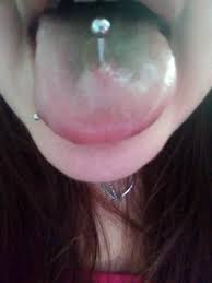 Your new piercing cleaner is ready for use! Problems With A Tongue Piercing Thriftyfun