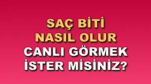 Sac Biti Nasil Olur Canli Gormek Ister Misiniz Youtube
