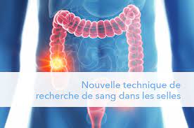 We did not find results for: Nouvelle Technique De Recherche De Sang Dans Les Selles Bionext Lab