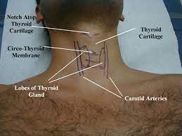 Learn everything about the neck anatomy with this topic page. Uc San Diego S Practical Guide To Clinical Medicine