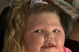 Fundraiser for Dean Bell by Claire Bell : Ella's journey