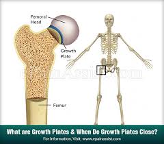 What Are Growth Plates When Do Growth Plates Close