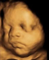 We did not find results for: 3d 4d Ultrasound Pricing Inside View 3d 4d Ultrasound