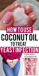 What To Do For Yeast Infection Home Remedy For V Gin L Yeast Infection Treat Yeast Infection Yeast Infection Relief Yeast Infection Cure