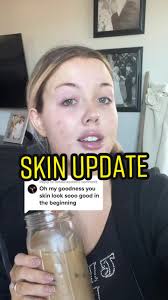 Skin Transformation Update: WiQo Treatment Review