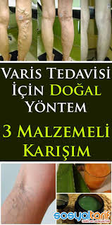 Varis Tedavisi Icin Dogal Yontem Homemade Skin Care Health Health Fitness