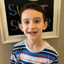 Hunter started treatment just as Paulene completed hers. Congratulations to  the both of you! 🤩✨ #leeorthodontics #braces #smile #invisalign