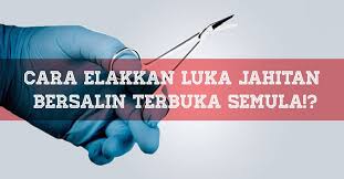 Anda sekarang tengah mengalami luka bersalin? Info Ibu Hamil Salam Iih Minta Siarkan Tq Luka Jahitan Facebook