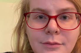 Fundraiser for Frances Vogel by Gwen Grohs : Help Astrid recover from a  traumatic brain injury