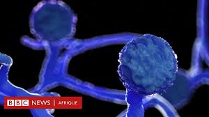 Atteinte du coeur,des reins, du cerveau parfois de l'oeil, en fin d'évolution apparition d'une couleur jaune orangée. Covid La Mucormycose Le Tres Dangereux Champignon Noir Qui Mutile Les Patients En Inde Bbc News Afrique
