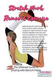 Pin On Stretch Marks Removal Guide