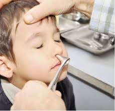 Home remedies alone will not cure the nasal vestibulitis is not a serious condition, but in rare cases, it can cause severe complications if a. Painful Nose Crusting In A Child Journal Of Urgent Care Medicine