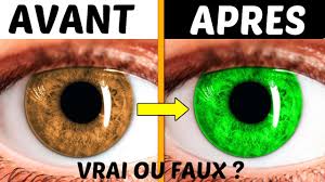Suivez les conseils de nos spécialistes et transformez facilement votre coin de verdure en un coin de paradis ! Peut On Vraiment Changer La Couleur De Ses Yeux Youtube