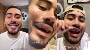 Carlinhos maia choca ao mostrar dentes naturais durante manutenção de lentes. Veja Antes E Depois De Famosos Com Lente De Contato Nos Dentes Kevinho Meionorte Com