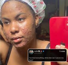 In keeping with Jarrod Doyle's request I'm not going to be an amateur  comedian. I shall tell a børing støry about my morning without some silly  joke. I've been covering myself from