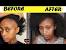 Sulfur Hair Growth Results