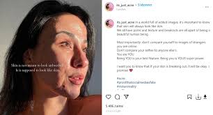 Elle enlève le maquillage pour montrer la réalité derrière les photos  parfaites