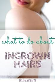 An ingrown hair is pretty much what it sounds like: Pin On Beauty Tips