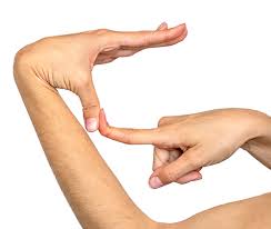 Image result for Hypermobility Signs