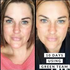 I have cystic acne, blackheads and scarring. I'm also tanned so I would  love to know which products work wonders