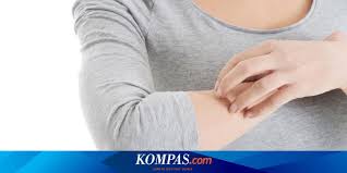 Jika anda mengatasi masalah gatal dengan menggaruk, tentu rasa gatal tersebut akan semakin parah anda rasakan. Tak Ada Riwayat Alergi Mengapa Sekarang Bisa Alergi