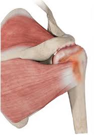 Image result for Rotator Cuff Rupture