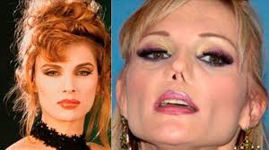 1 skin cerity antes y despues. Alejandra Guzman Y Otros Artistas Que Deformaron Su Rostro Por Abuso De Cirugias En Busca De Belleza Insta Fotos La Republica