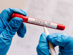If approved, the blood test could show if your immune system has developed coronavirus antibodies. Coronavirus Symptoms Why A Negative Test May Not Mean You Are Safe From Covid 19 The Times Of India
