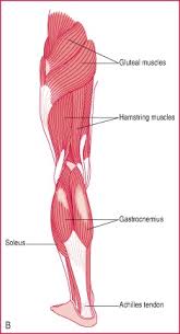 A muscle strain is a stretch or tear of muscle fibers. Quadrate Muscle Of Thigh Liberal Dictionary