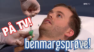 Du skal ikke se bort ifra at det er en medvirkende årsak. Kjetil Gjennomgar En Benmargsprove Pa Tv L Forste Episdoe Av Hva Feiler Det Deg Youtube
