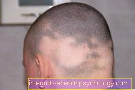 Punca utama rambut gugur selepas bersalin adalah hormon yang tidak stabil. Rambut Gugur Dermatologi Online