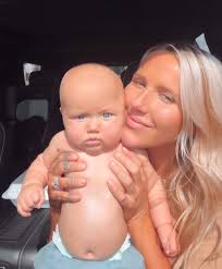 What to expect after craniosynostosis surgery?