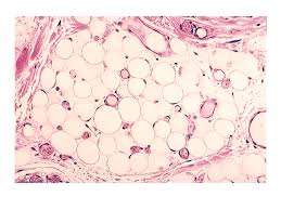 What do you prefer to learn with? Mit Brigham Team Designs Fat Fighting Nanoparticles That Change White Adipose Tissue To Brown Fiercepharma