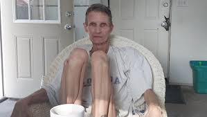 Fundraiser by Marcus Bozeman : Support Dana's Fight Against Lung Cancer