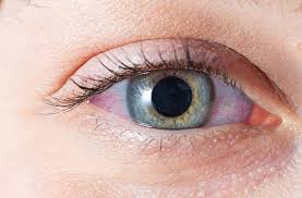 Image result for Sclera