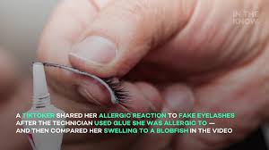 From wikimedia commons, the free media repository. Woman Warns Tiktok After Reaction To Eyelash Extensions My Face Actually Looked Like A Blobfish