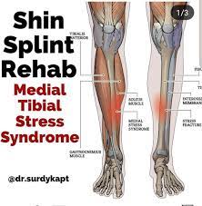 If you're an athlete, avid runner, or you enjoy a brisk walk, you may have experienced painful shin splints. Move Forward From Your Shin Splints The Spot Athletics