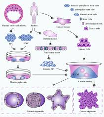 Refractory cancer refers to cancer that may be resistant at the beginning of treatment, or becomes resistant during treatment. Organoid Technology And Applications In Cancer Research Journal Of Hematology Oncology Full Text
