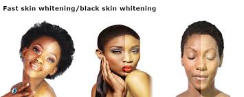 To prepare this pack, you need four tablespoons mayonnaise, one teaspoon lemon juice, and one teaspoon olive oil. Black Skin African Skin Remove Dark Spot Anti Aging Best Skin Whitening Cream Soap Aliexpress