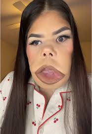 Car Driving Down a Hill with Dr Robert Poley and Siren Hunni