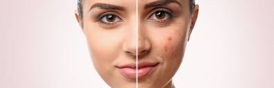 Skin Therapy & Treatments Spa San Mateo, San Francisco