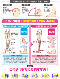 new ひざまっすぐテーピングハイソックス ３本指タイプ aka 002 カサハラ式 公式サイト カサハラ フットケアショップ 骨盤矯正 ダイエット 健康 運動 健康になる